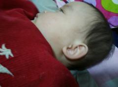  宝宝七个月脸上长小……