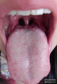 舌头根部有疙瘩 舌头……
