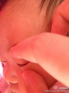 宝宝的眼睫毛总是贴在……