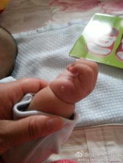 宝宝左手掌小拇指下方……